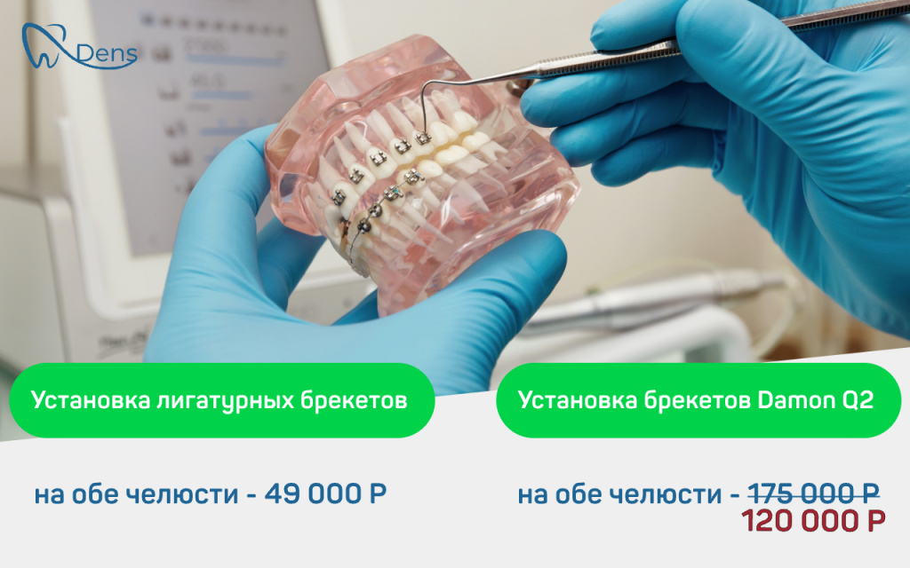 Установка брекетов